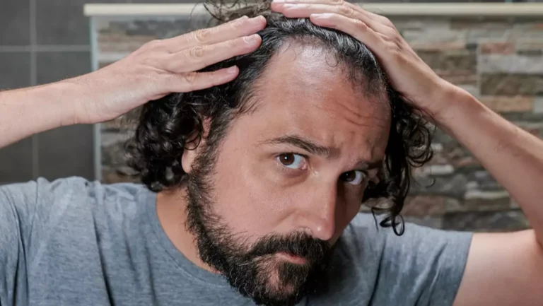 doctor-warns-common-doctor-warns-common-drink-could-cause-hair-loss-and-how-to-prevent-it-from-happening.webp