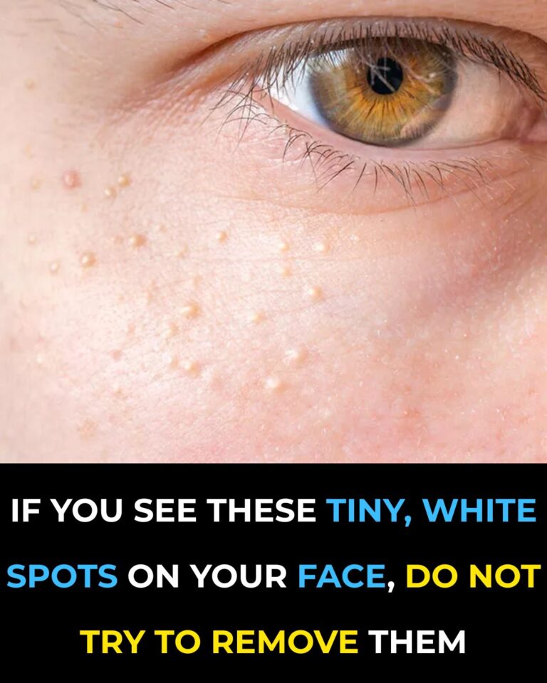 recipej-if-you-have-tiny-white-bumps-on-your-face-dont-try-to-remove-them-heres.jpg