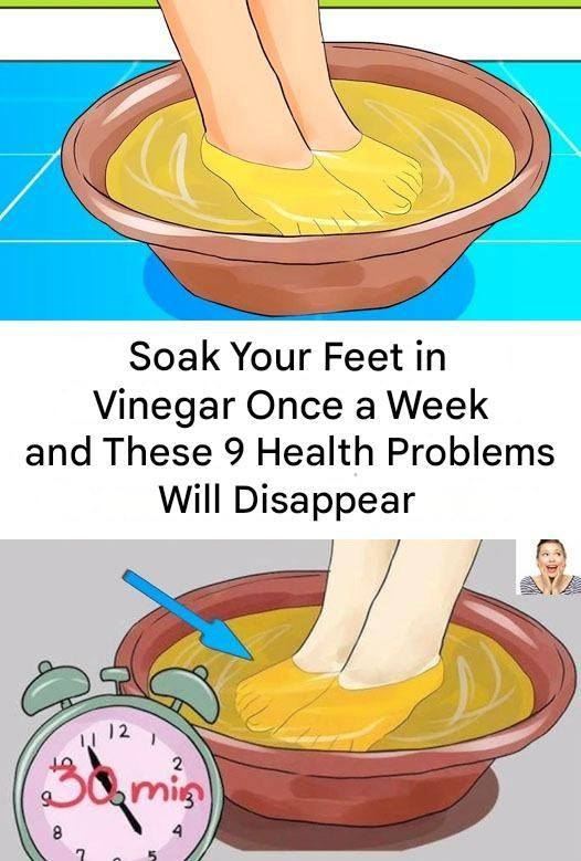 Soak Your Feet in Vinegar Once a Week The Simple Home Remedy Many People Over 60 Swear By