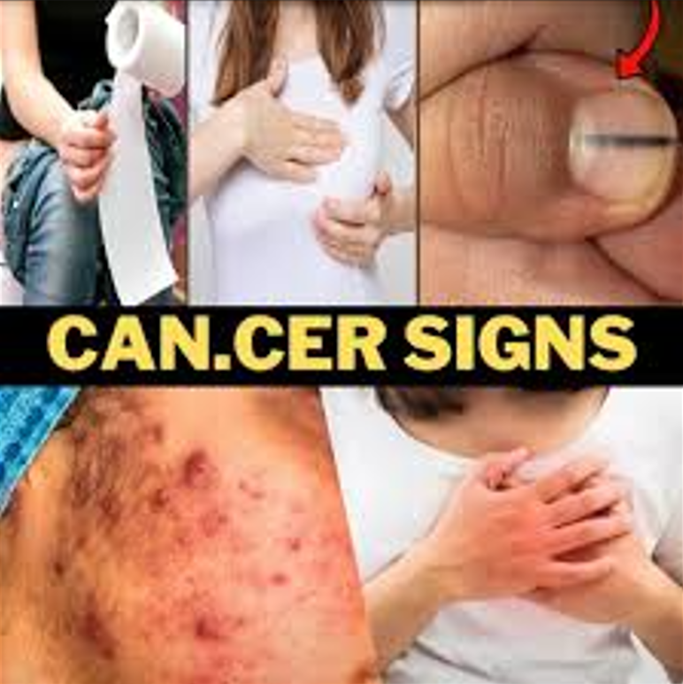 Hidden Signs of Cancer Many People Ignore Until It’s Too Late