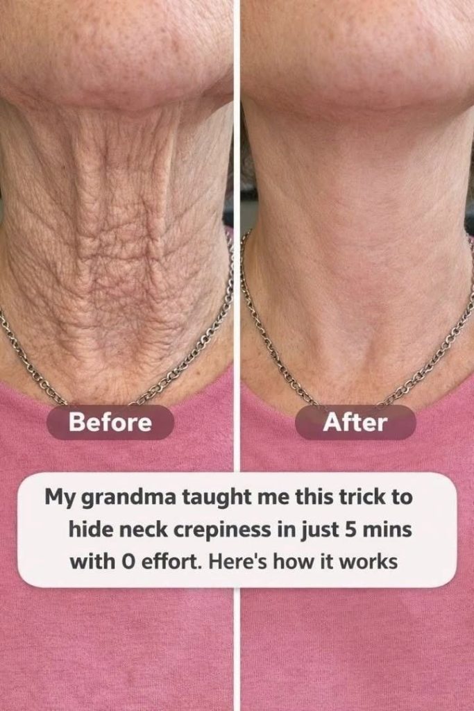 heal neck heal neck