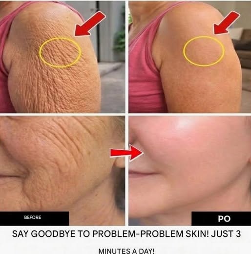 How to Improve the Appearance of Wrinkles with Daily Habits